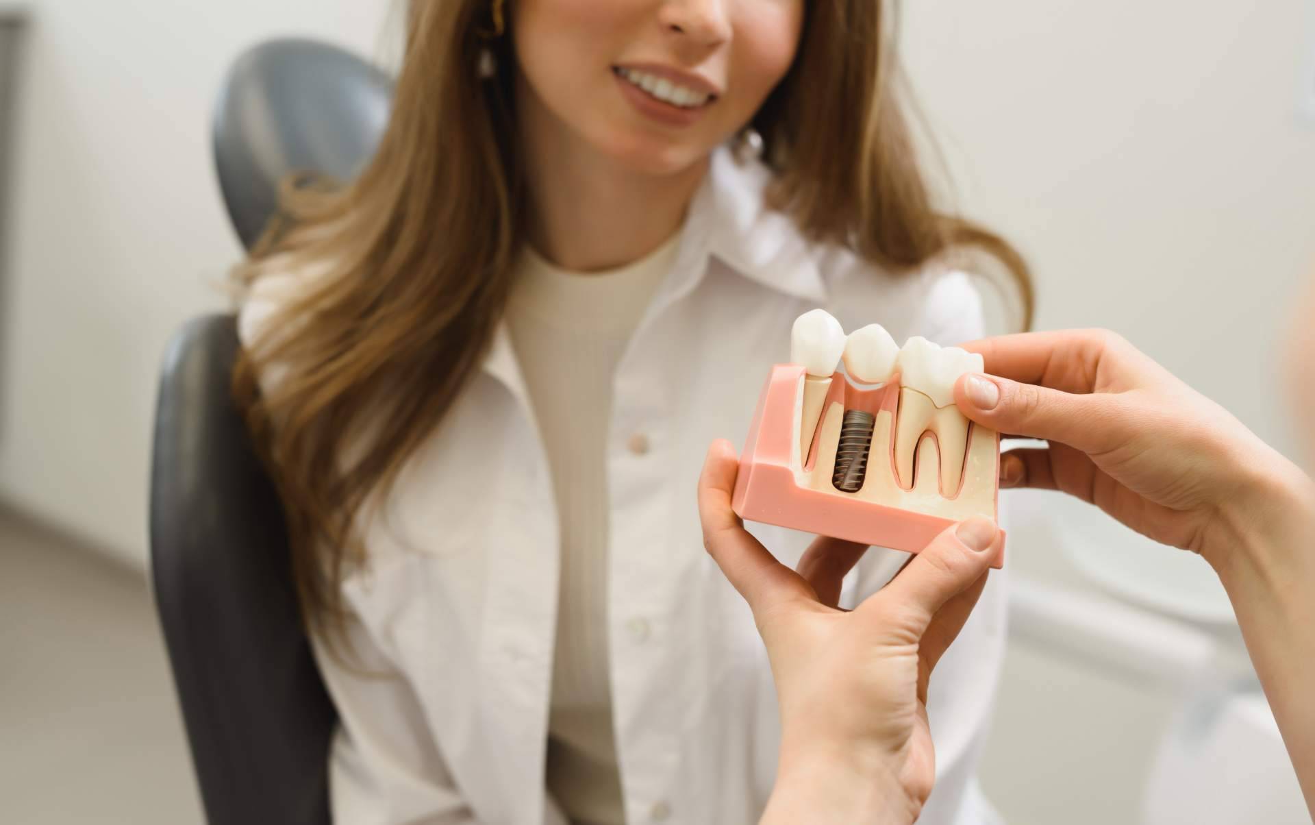 Clínica DeltaDent, razones para realizarse implantes dentales