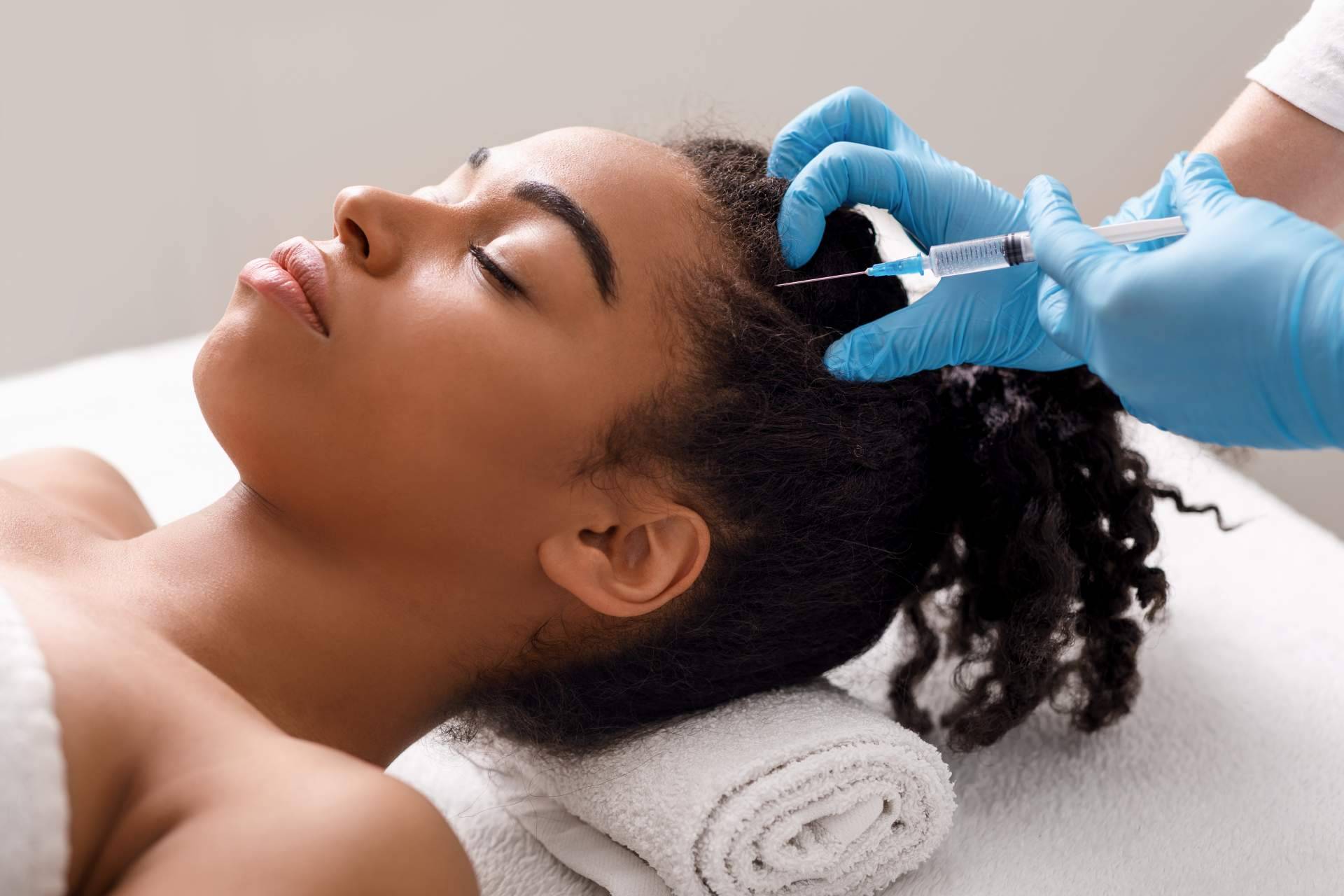 ¿Cuáles son los beneficios de la mesoterapia capilar realizada por el Dr. Bruno Jacobovski?
