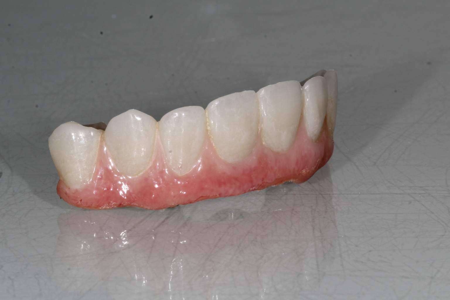Implant Clinics resalta los beneficios de su tratamiento ALL ON 4