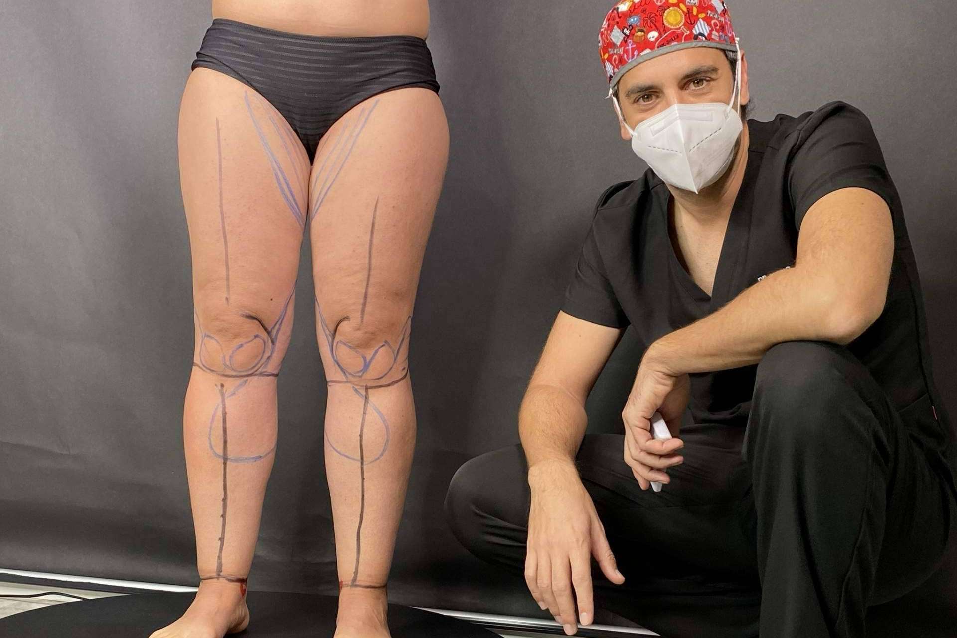 Es creado el Instituto Valenciano de Lipedema, IVALI