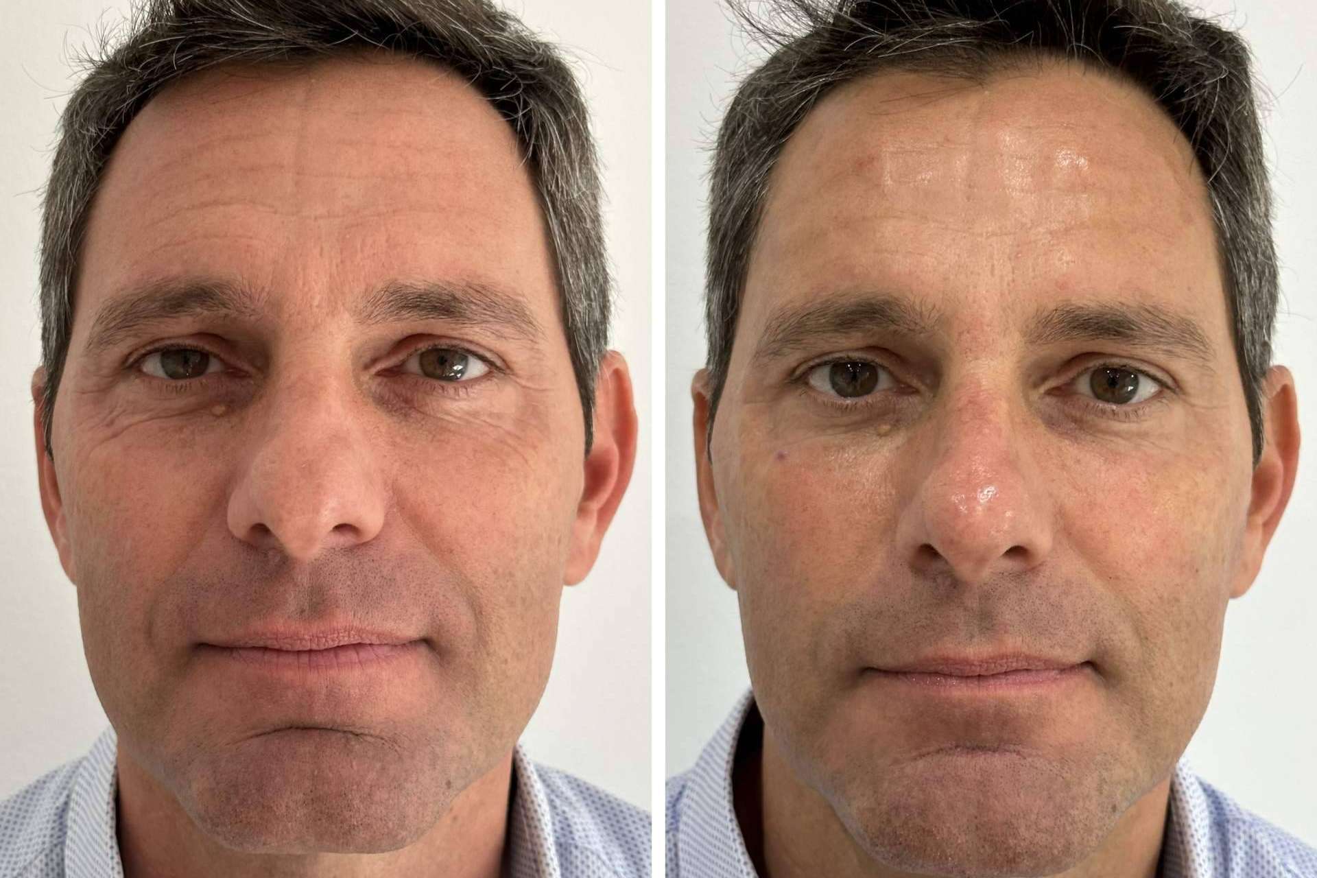 Mejorar la apariencia con los tratamientos faciales de Clínica VISO