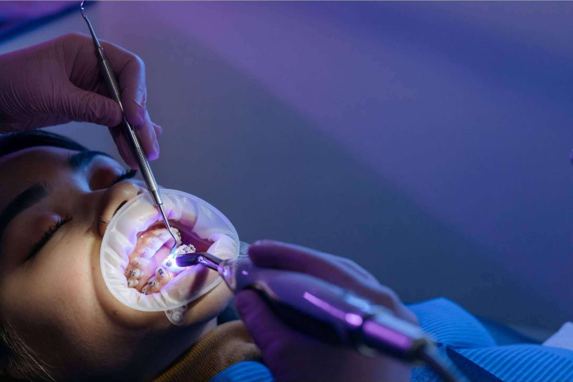 Soluciones dentales completas y asequibles en Madrid de la mano de Denty Dent